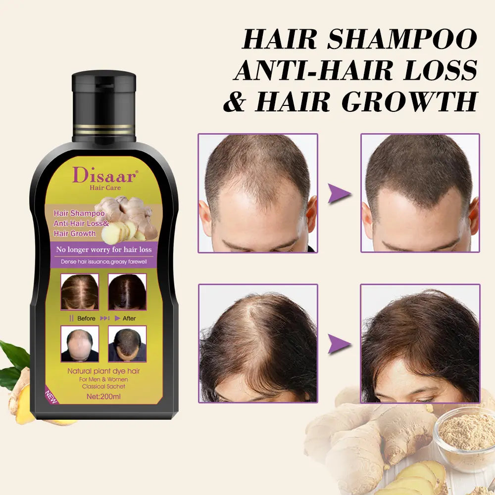 Shampoo Anticaída de Jengibre